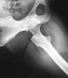 Zoom image: Radiological image