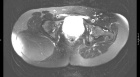 Zoom image: Radiological image