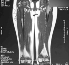 Zoom image: Radiological image