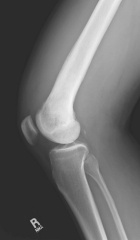 Zoom image: Radiological image