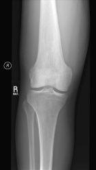 Zoom image: Radiological image