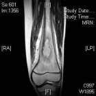 Zoom image: Radiological image