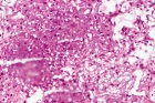 Zoom image: Cell stain