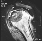 Zoom image: Radiological image