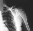 Zoom image: Radiological image