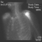 Zoom image: Radiological image