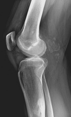 Zoom image: Radiological image