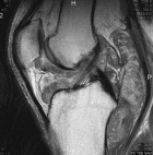 Zoom image: Radiological image