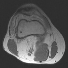 Zoom image: Radiological image