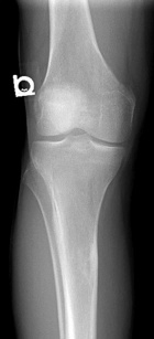 Zoom image: Radiological image