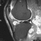 Zoom image: Radiological image