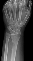 Zoom image: Radiological image