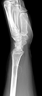 Zoom image: Radiological image