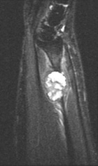 Zoom image: Radiological image