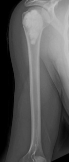 Zoom image: Radiological image