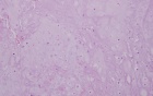 Zoom image: Cell stain