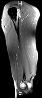 Zoom image: Radiological image