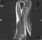 Zoom image: Radiological image