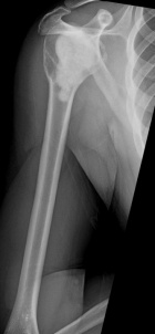 Zoom image: Radiological image