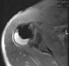 Zoom image: Radiological image