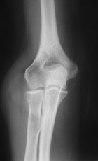 Zoom image: Radiological image