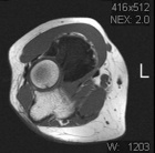 Zoom image: Radiological image