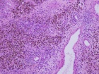 Zoom image: Cell stain