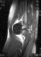 Zoom image: Radiological image