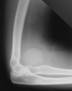 Zoom image: Radiological image