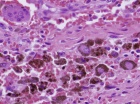 Zoom image: Cell stain