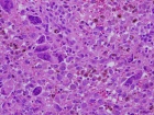 Zoom image: Cell stain