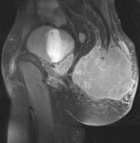 Zoom image: Radiological image