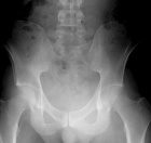 Zoom image: Radiological image