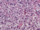 Zoom image: Cell stain