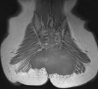 Zoom image: Radiological image