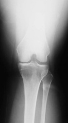 Zoom image: Radiological image