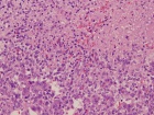 Zoom image: Cell stain