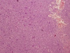 Zoom image: Cell stain