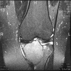 Zoom image: Radiological image