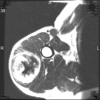 Zoom image: Radiological image