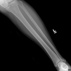 Zoom image: Radiological image