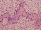 Zoom image: Cell stain