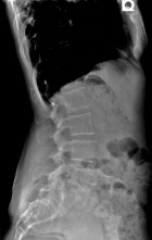 Zoom image: Radiological image