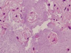 Zoom image: Cell stain