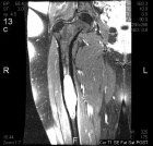 Zoom image: Radiological image