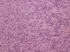 Zoom image: Cell stain
