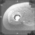 Zoom image: Radiological image