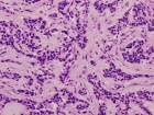 Zoom image: Cell stain