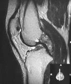 Zoom image: Radiological image