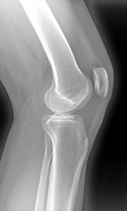 Zoom image: Radiological image